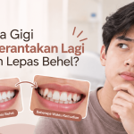 Gigi berantakan lagi setelah lepas behel